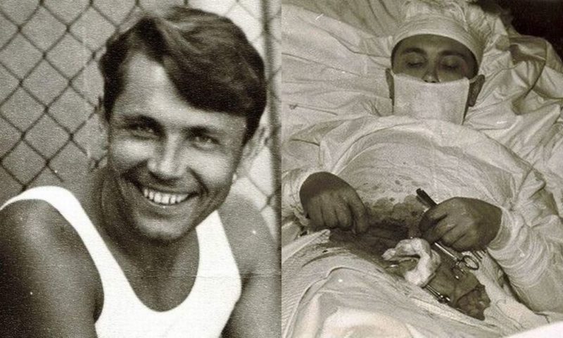 The impressive story of Leonid Rogozov, the man who operated on himself