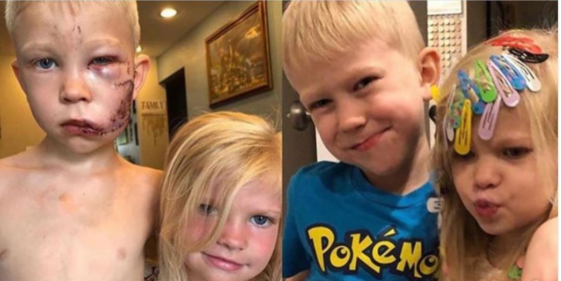 Bridger Walker, a superhero who saved his 6-year-old sister after a dog attack