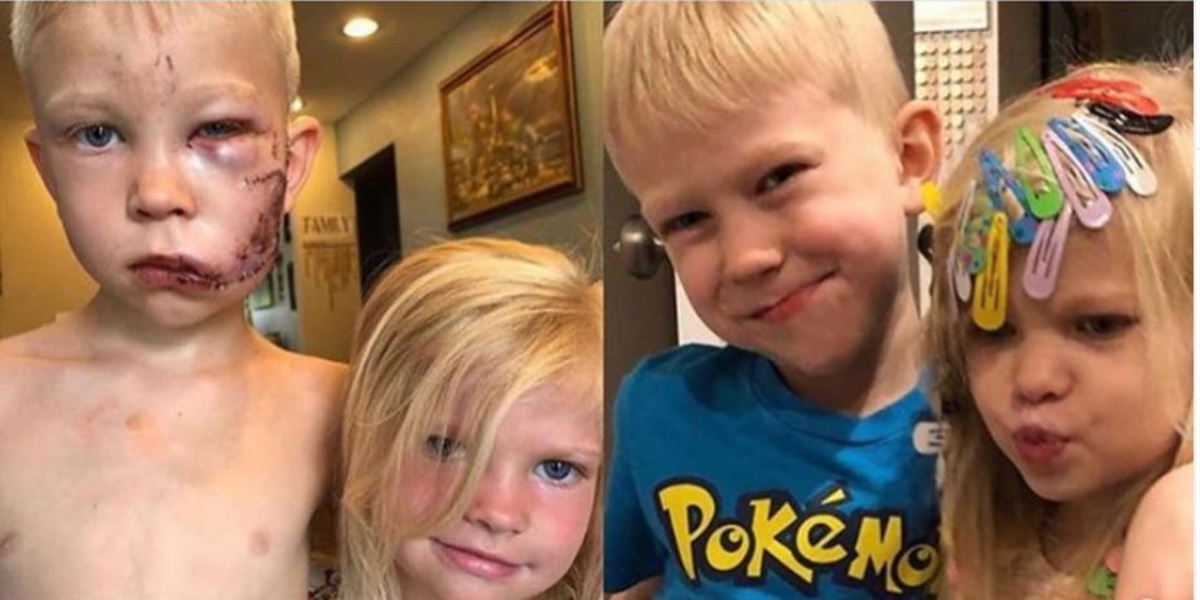 Bridger Walker, a superhero who saved his 6-year-old sister after a dog attack