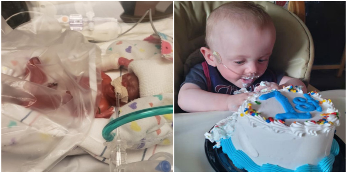 The world's most premature baby celebrated his first birthday