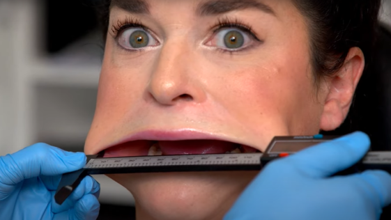 Samantha Ramsdell, the Guinness World Record holder for largest mouth in the world